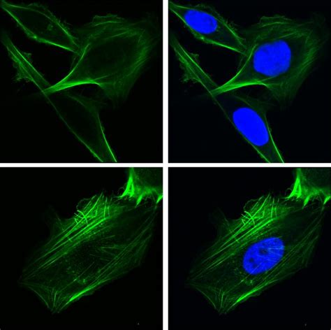 Unexpected Role for Chaperone Protein in Cancer Spread