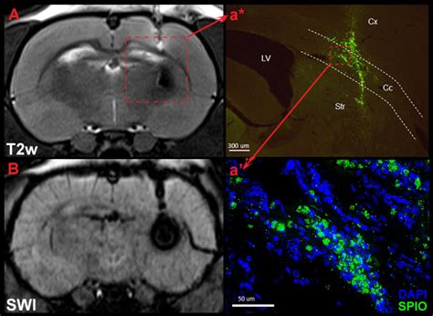 Rat brain MRI and histology. A, B -in vivo MRI 7 days after labelled ...