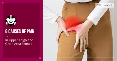 Intense Groin Pain Female Discount | aria-database.com