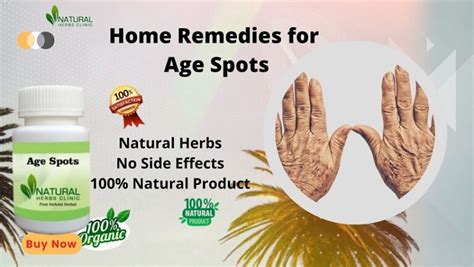 10 Natural Herbal Remedies for Age Spots - Natural Herbs Clinic Blog