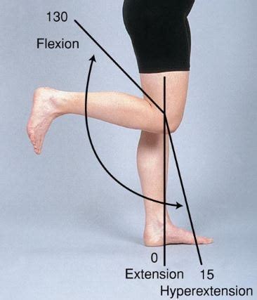 Hyperextended Knee - Symptoms, Recovery Time, Treatment