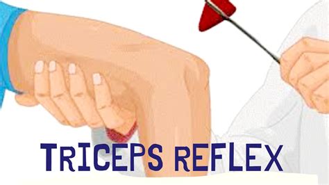 Triceps Deep Tendon Reflex | Deep Tendon Reflexes - YouTube