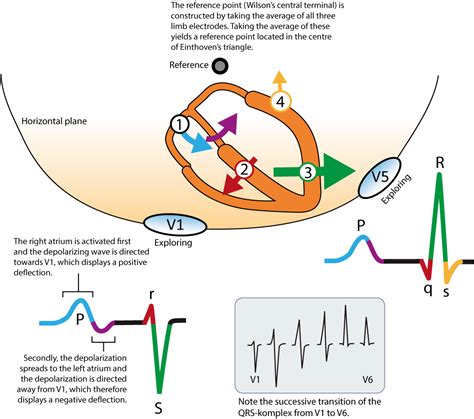 The QRS complex: ECG features of the Q-wave, R-wave, S-wave & duration ...