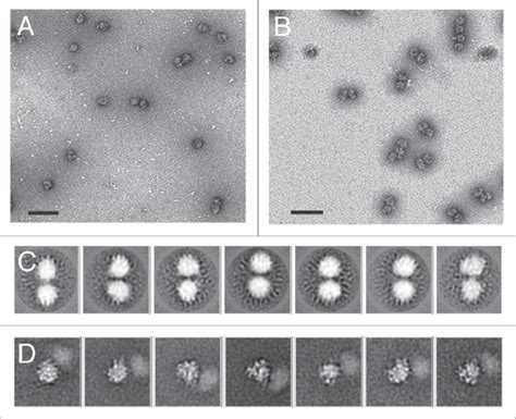 Ribosomes Electron Micrograph