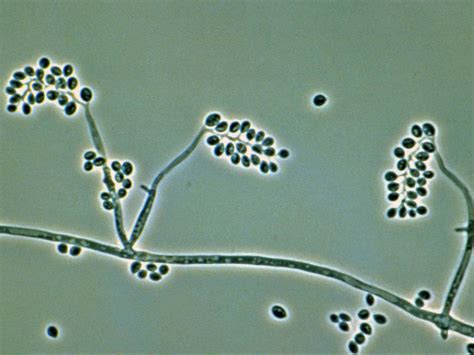 Beauveria = bent/branching conidiophores | Parasitologia, Microbiologia ...