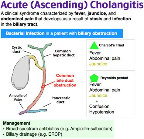 the diagram shows how to use an acne ascending cholamgicist