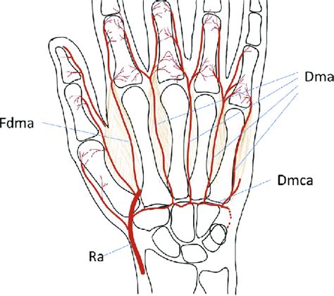 Dorsal arterial system of the hand. Dma, dorsal metacarpal arteries ...