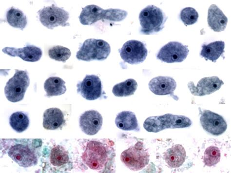 Endolimax nana parasite (Trophozoite and Cyst) | Medical Laboratories