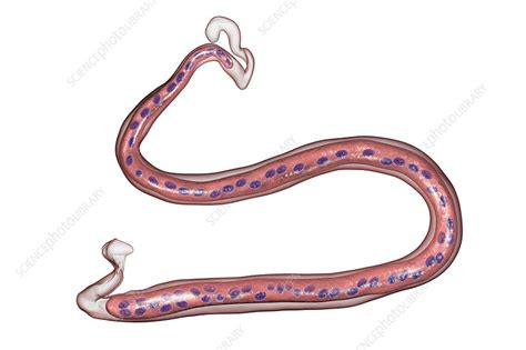 Loa loa parasitic worm, illustration - Stock Image - F022/1861 ...