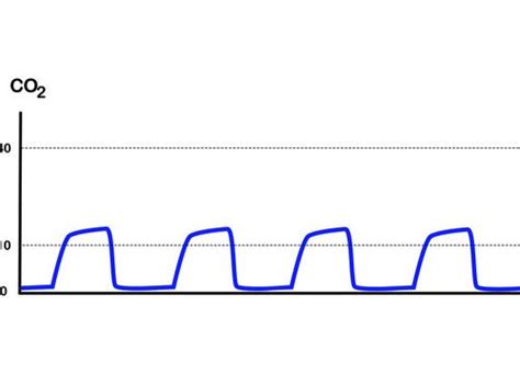 Introduction to Capnography - Zug Medical Systems