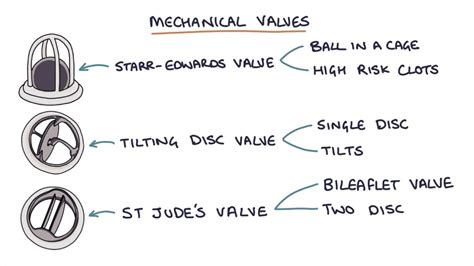 Prosthetic Heart Valves: Visual Explanation for Students - YouTube