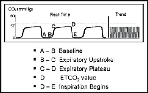 Normal capnogram (normal EtCO2 value ranges from 35 -45 mm Hg ...