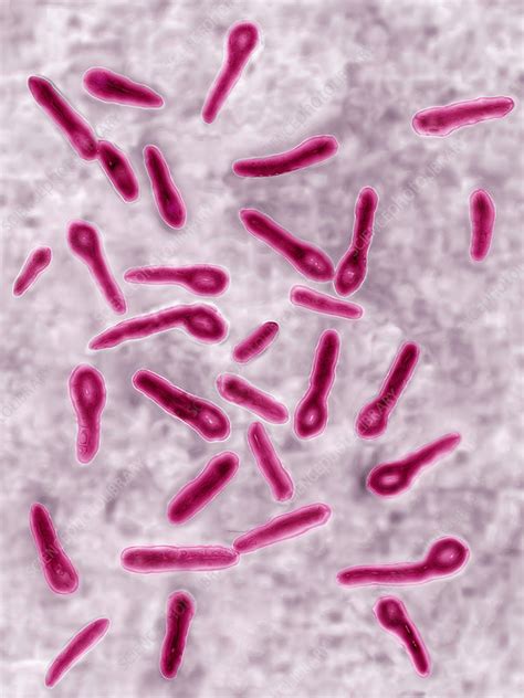 Tetanus - Clostridium tetani - Oxford Sandy and Black Pig Foundation ...