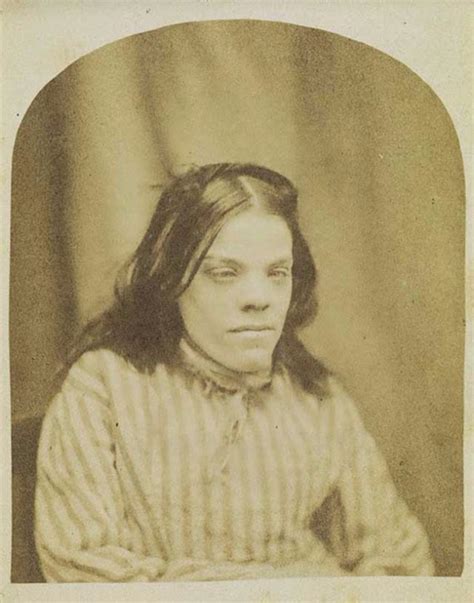 Physiognomic Portraits of Patients from Surrey County Asylum, ca. 1855 ...