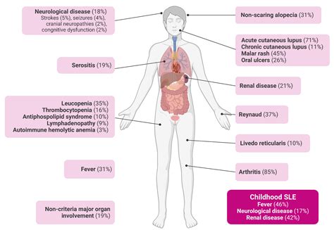 Systemic Lupus Erythematosus Notes Docx Systemic Lupus Erythematosus ...