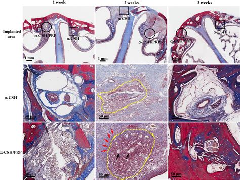 Figure 1 from An Innovative Bioceramic Bone Graft with Platelet-Rich ...