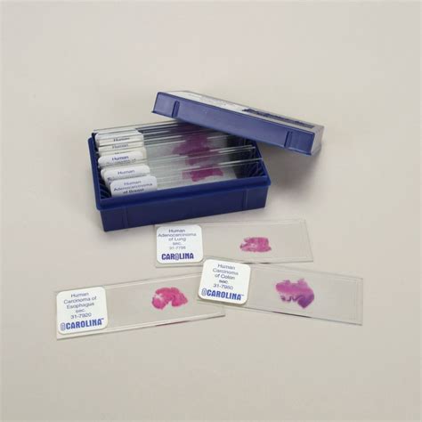 Malignant Tissues Microscope Slide Set | Carolina.com