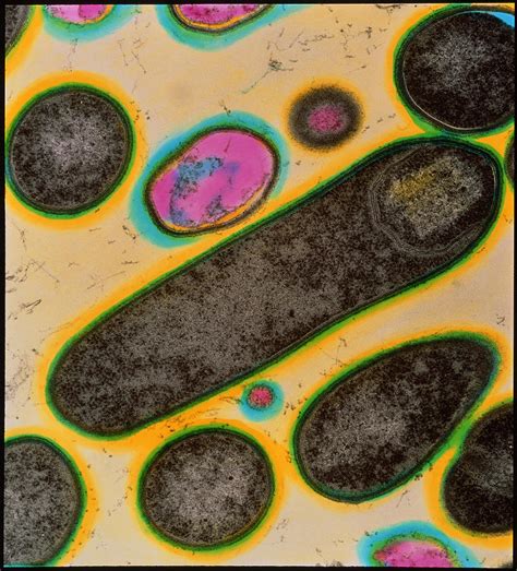 Clostridium Bacteria Photograph by A. Dowsett, Health Protection Agency ...