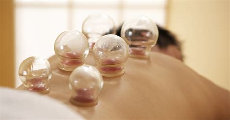 Cupping Therapy for Pain | Ananta Wellness