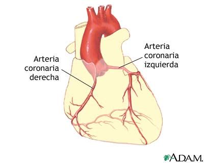 Angioplastia coronaria con balón - Serie—Anatomía normal: MedlinePlus ...