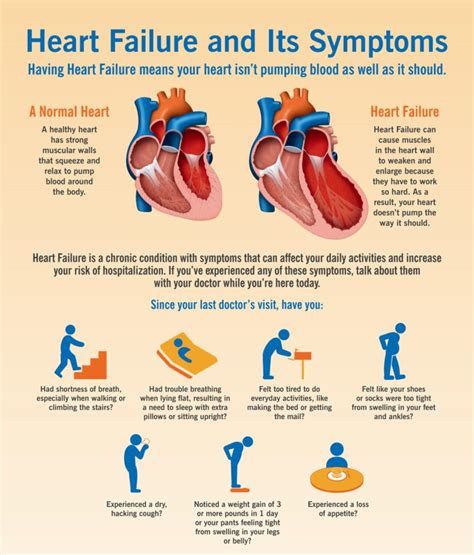 Congestive Heart failure: Causes and Types | Jugaadin News