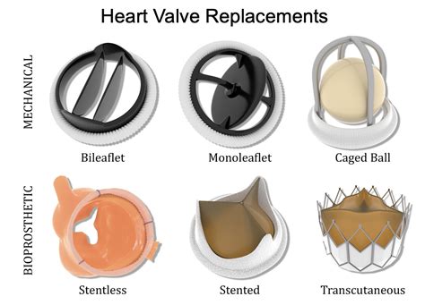 Heart valve anatomy, valve disease and heart valve replacement