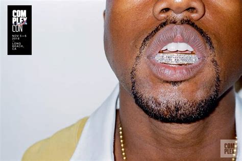 Kanye West Teeth Before And After