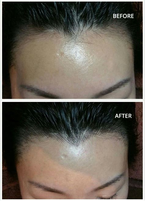 Pin by Janelle Simmons on hairline tattoo | Hairline tattoo, Hairline ...