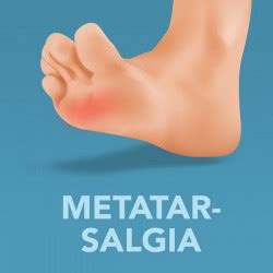 Cushioned Orthotic Insoles for Metatarsalgia