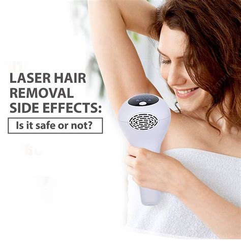 Laser Hair Removal Side Effects