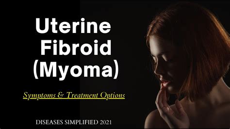 Fibroid (Myoma) Symptoms & Treatment Options - YouTube