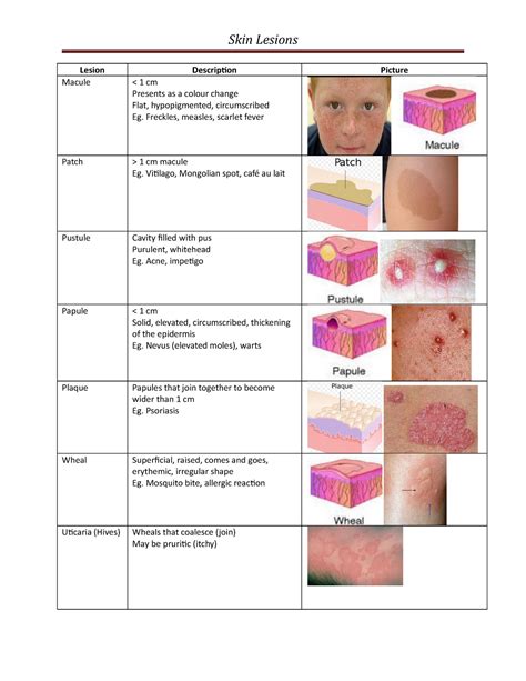 Skin Lesions Causes