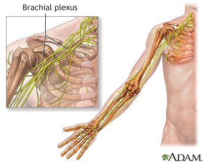 Brachial plexus Information | Mount Sinai - New York