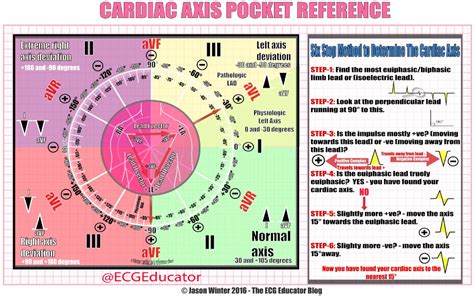 ECG Educator Blog : Cardiac Axis Made Easy in 2021 | Critical care ...