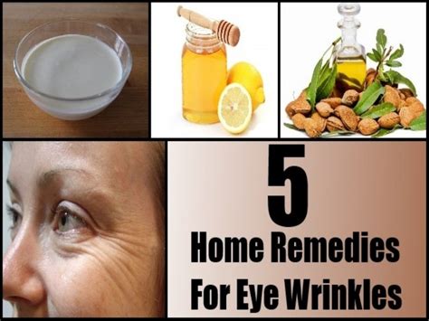 5 Best Home Remedies For Eye Wrinkles