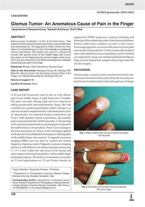 (PDF) Glomus Tumor: An Anomalous Cause of Pain in the Finger