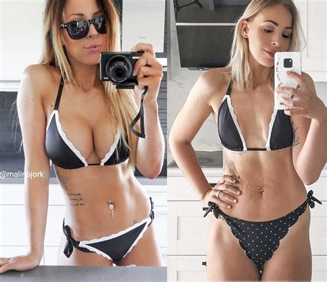 Influencer Says She's 'Proud' After Having Breast Implants Removed: 'I ...