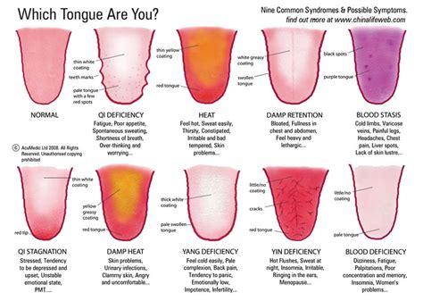 Stick Out Your Tongue! Understanding Chinese Tongue Diagnosis