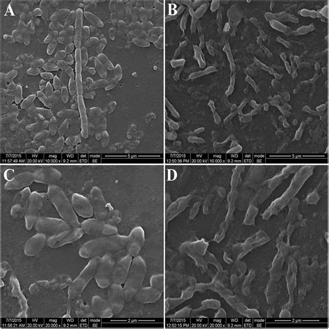 Scanning electron microscopy of biofilm formation: (A) Biofilm ...