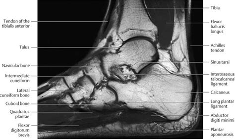 Foot Anatomy Mri Radiology