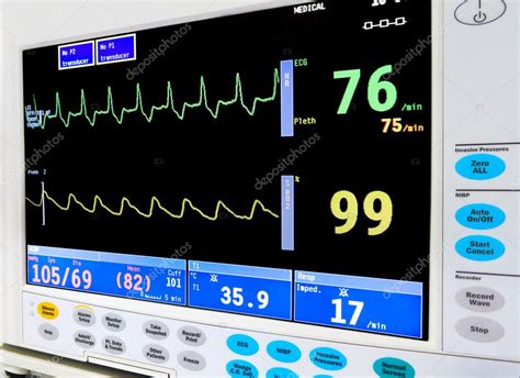 ICU cardiac monitor — Stock Photo © beerkoff1 #6096648