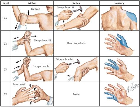 Brachioradialis Reflex