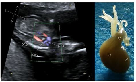 Figure 1 from Diagnostic value of systematic ultrasonography for ...