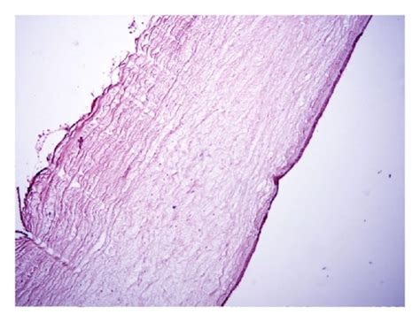 Histology picture of the cornea, stained with hematoxylin and eosin ...