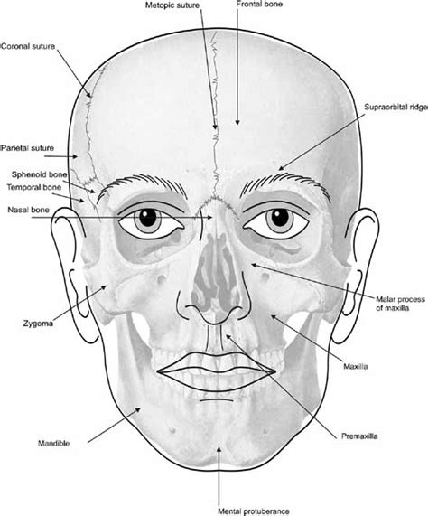 Elements of Morphology: Human Malformation Terminology