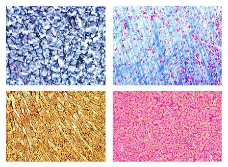 Histology: Connective tissues, 10 microscope slides | PHYWE