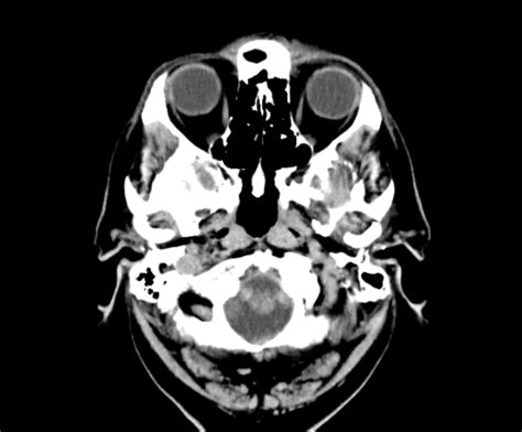 Head CT - Insight Medical Imaging