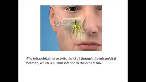 Intraoral infraorbital nerve block - YouTube