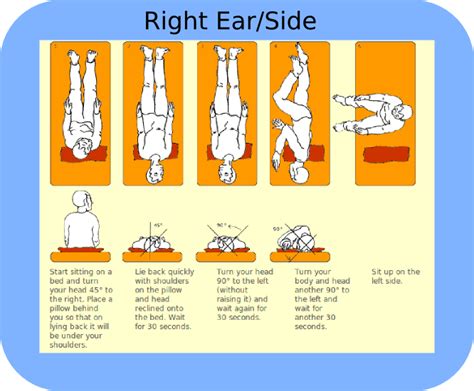 Epley maneuver patient handout pdf