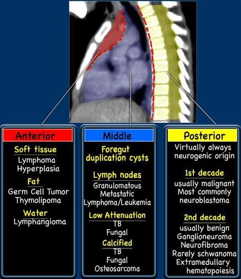 Chest Section